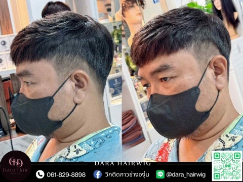 วิกผมปิดผมบางติดกาว